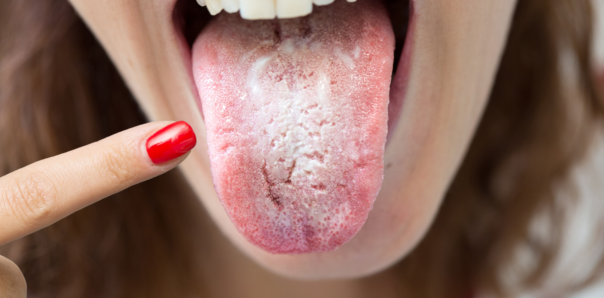 #1E73BE17 (11) #1E73BE17 (11)