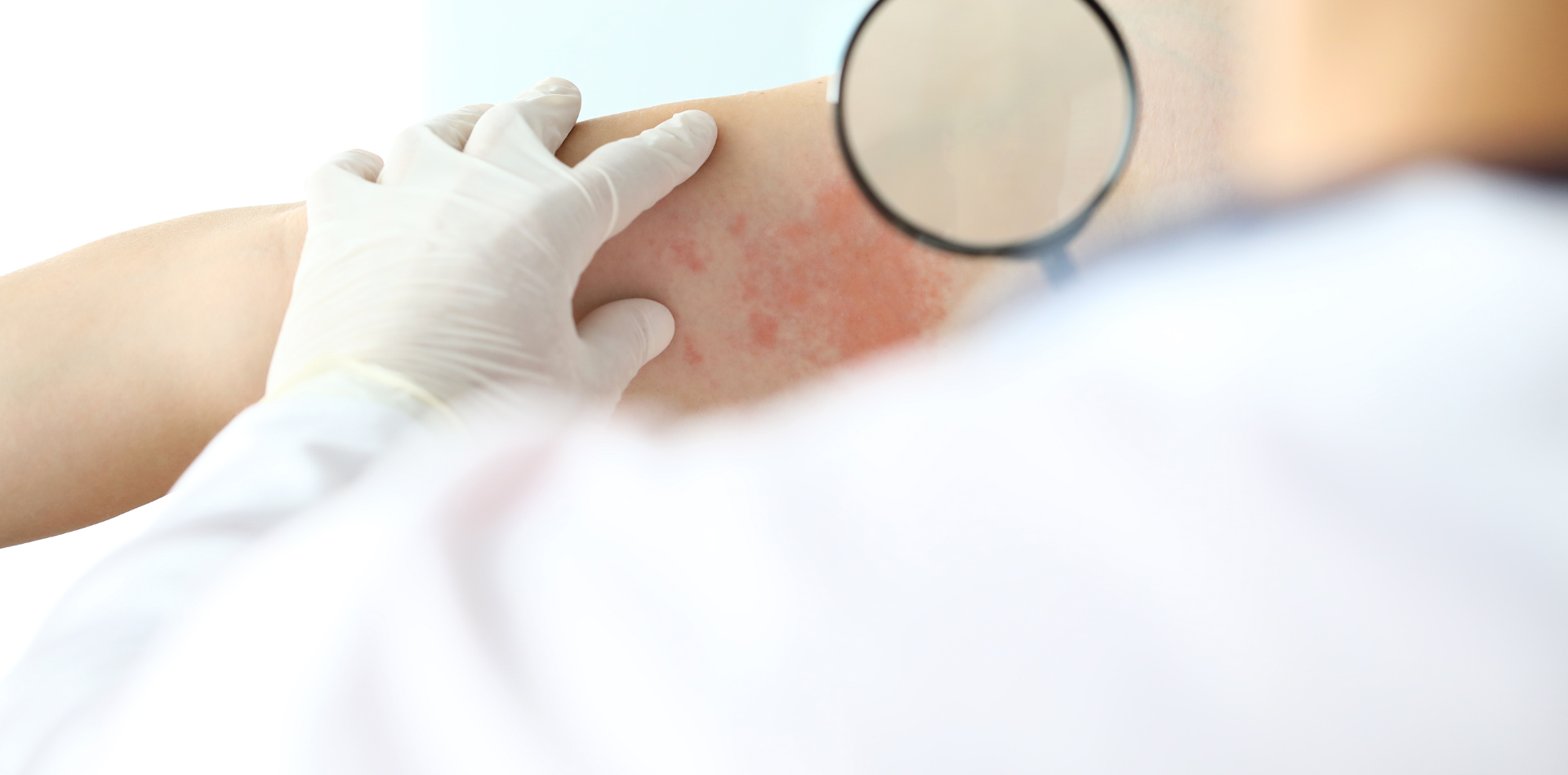 Visita dermatologica urgente a Milano