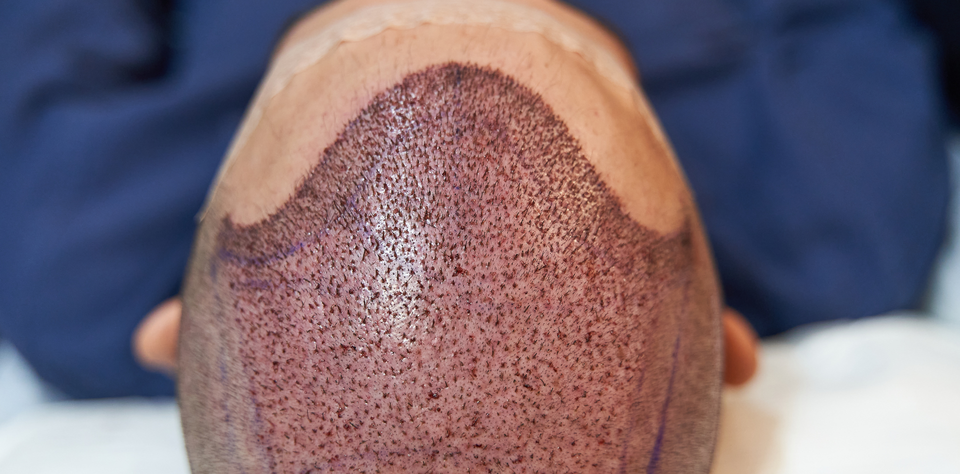 #1E73BE17 (8) #1E73BE17 (8)