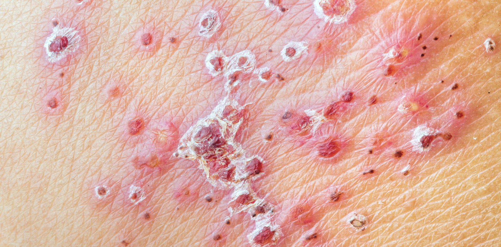 #1E73BE17 (9) Trattamenti di venereologia a Milano